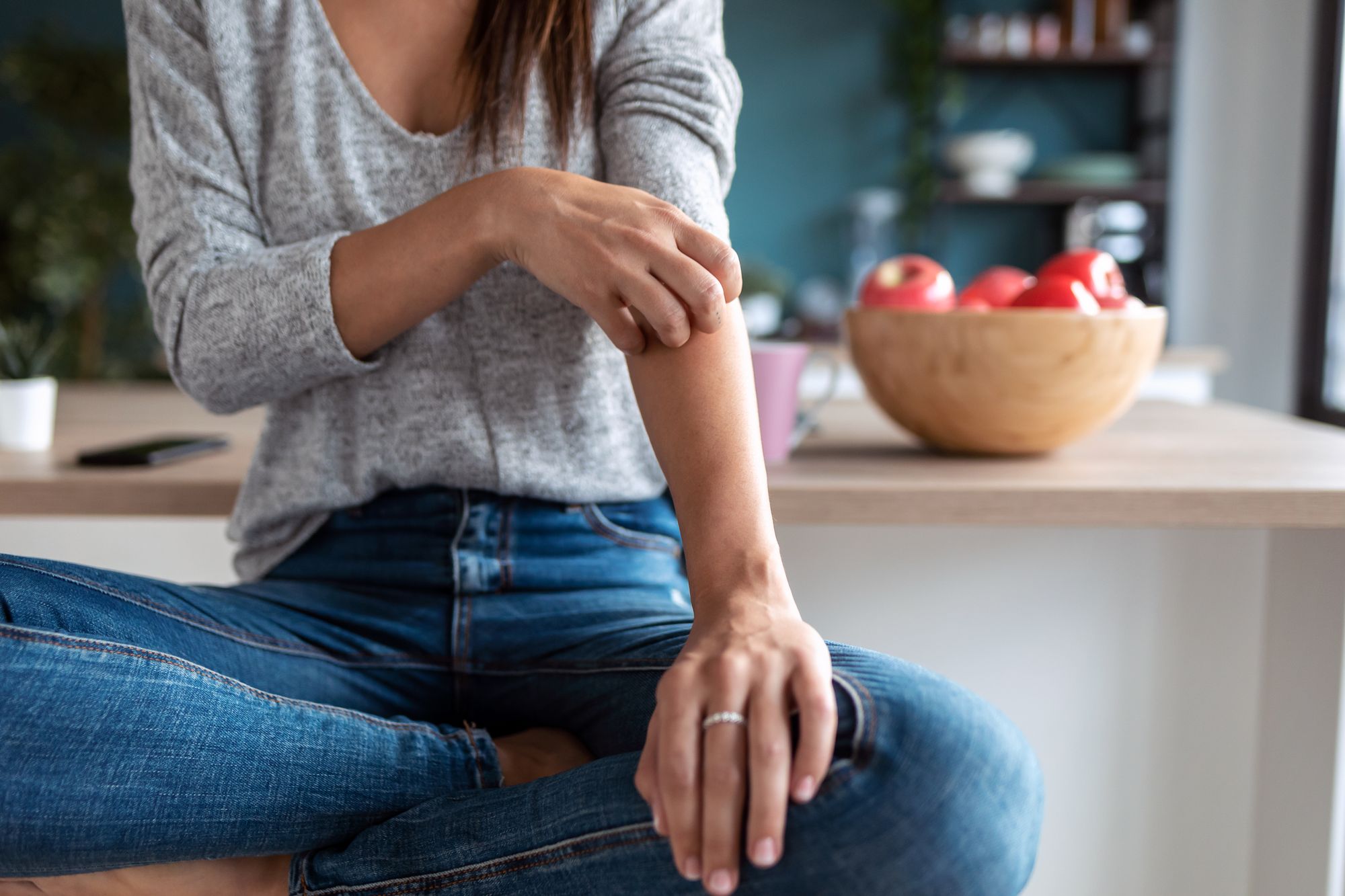 young woman scratching her arm